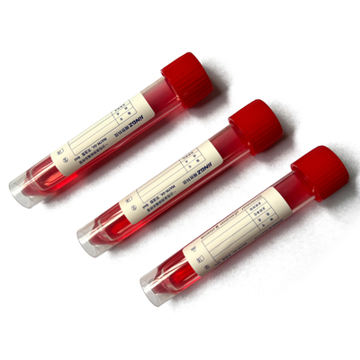Red Cap 10ml Spesimen Swab Transport Tube Dengan Solusi 3ml