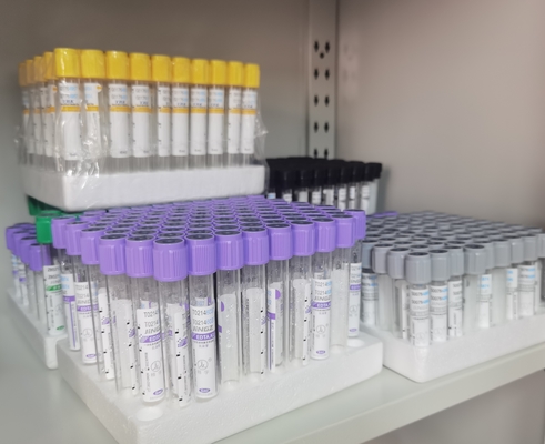 Tabung EDTA Warna Ungu Dengan Label Ungu Untuk Pengumpulan Sampel yang Optimal